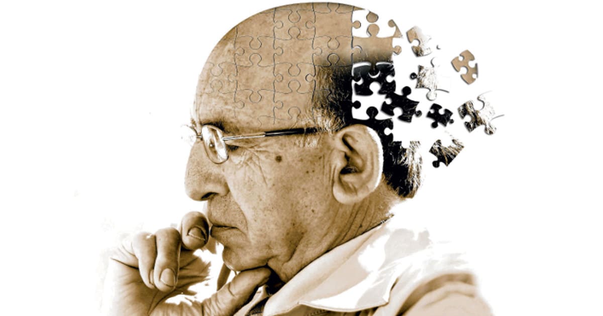 Old man Alzheimer's Disease 