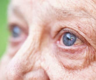Watch for 4 common eye diseases that cause blindness in aging eyes
