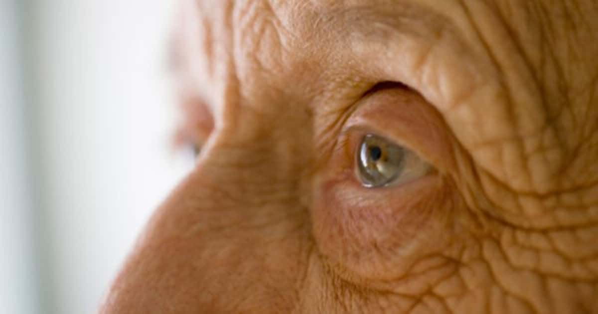 Dementia and Eyesight: An Expert Explains 3 Common Changes and ...