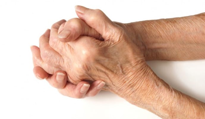 Simple arthritis aids make everyday activities easier, including dressing, preparing meals, eating, writing, and more
