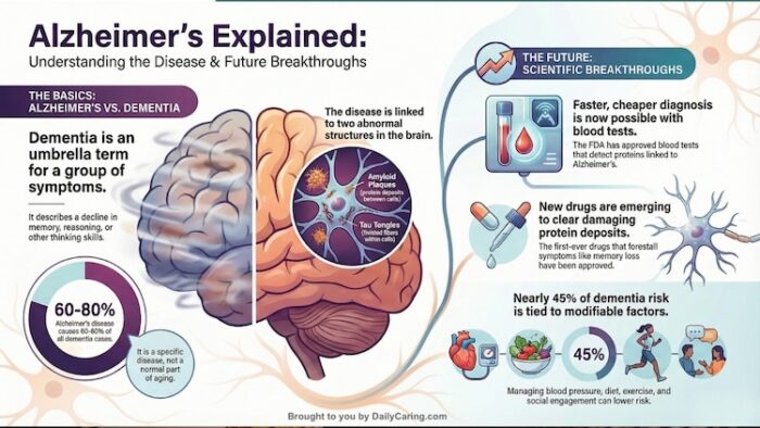 Alzheimer's Disease infographic: All about Alzheimer's Disease