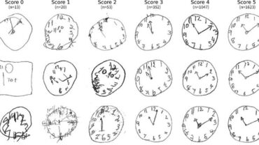 Slums Clock Test Comprehensive List of Cognitive Screening Tests for Dementia